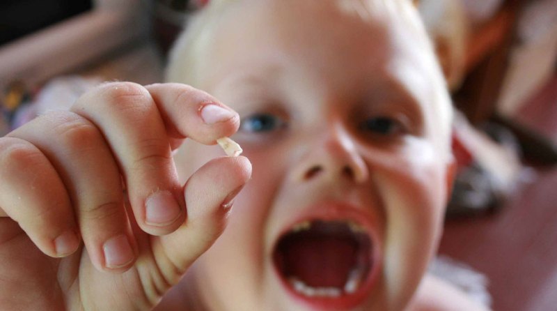 لقی دندان در کودکان