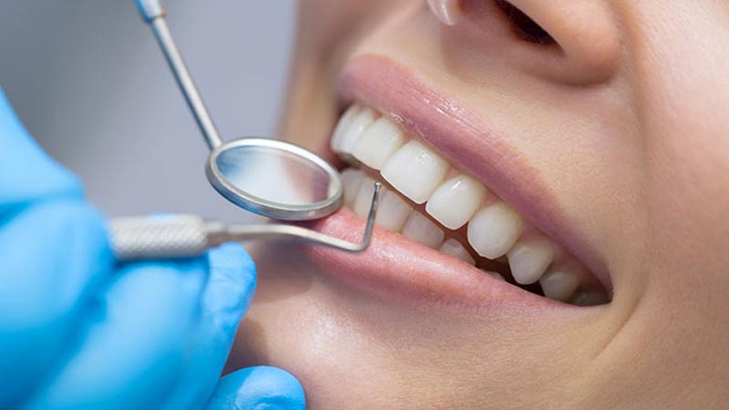 مراقبت از بریج یا پل دندان