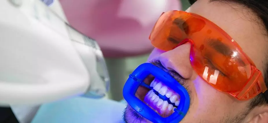  بلیچینگ در کلینیک دندانپزشکی