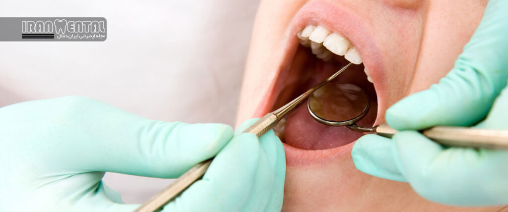 تعرفه‌های دندانپزشکی در سال جدید