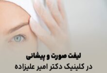 لیفت صورت و پیشانی در کلینیک دکتر امیر علیزاده: زیبایی و جوانی را تجربه کنید