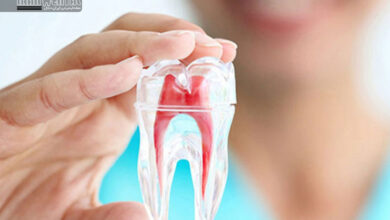 درمان ریشه و تاثیر آن بر قند خون و چربی خون: آنچه بیماران باید بدانند