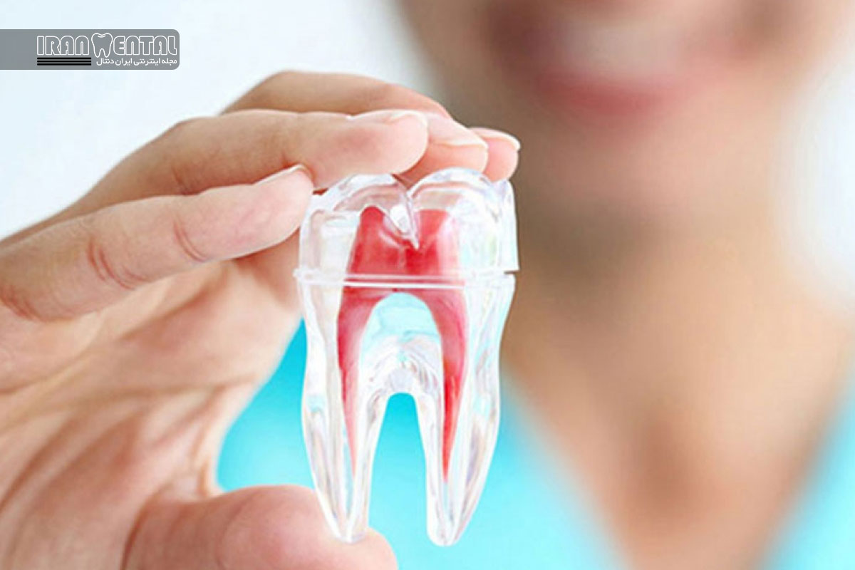 درمان ریشه و تاثیر آن بر قند خون و چربی خون: آنچه بیماران باید بدانند