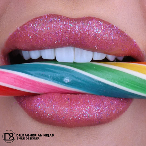 انجام کامپوزیت لبه شیشه ای اصفهان