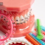 ارتودنسی سریع چیست و برای چه کسانی مناسب است؟