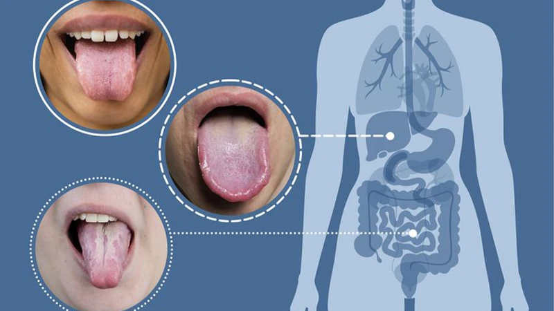 درمان مشکلات گوارشی و کبدی برای از بین بردن زردی زبان