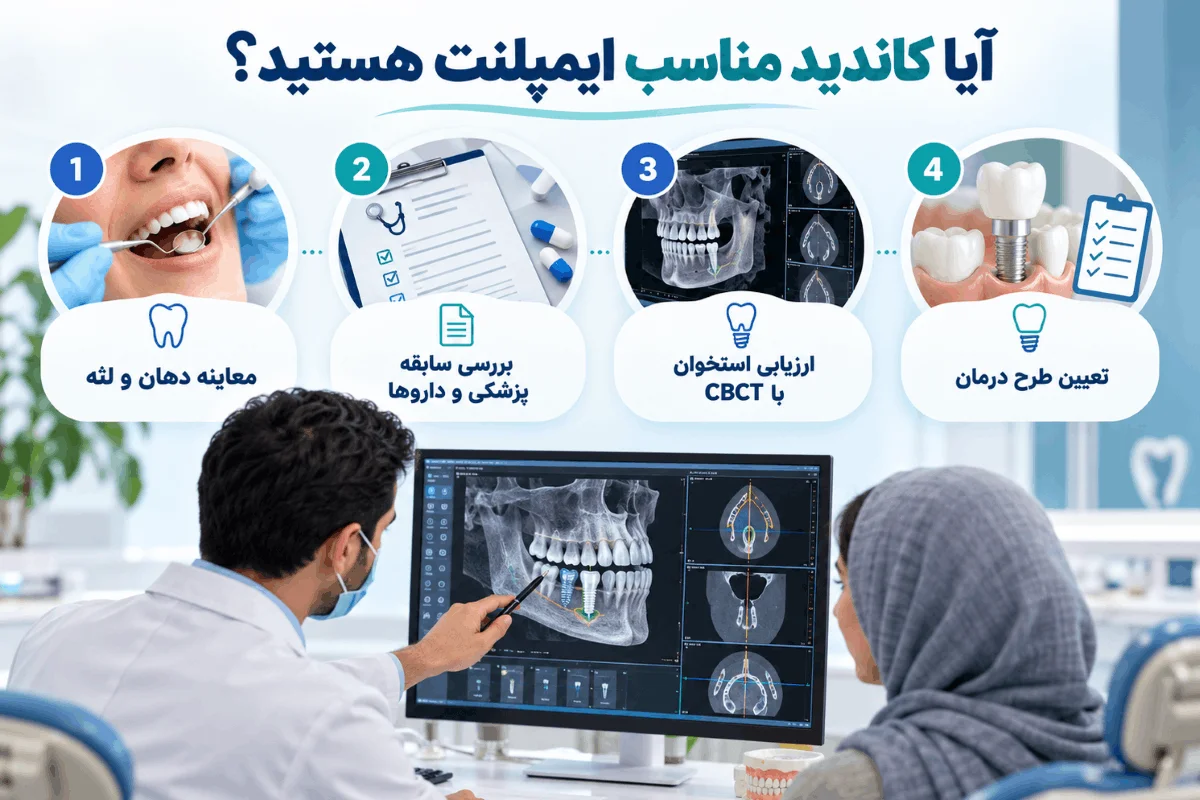 مراحل بررسی کاندید مناسب ایمپلنت با معاینه و عکس CBCT
