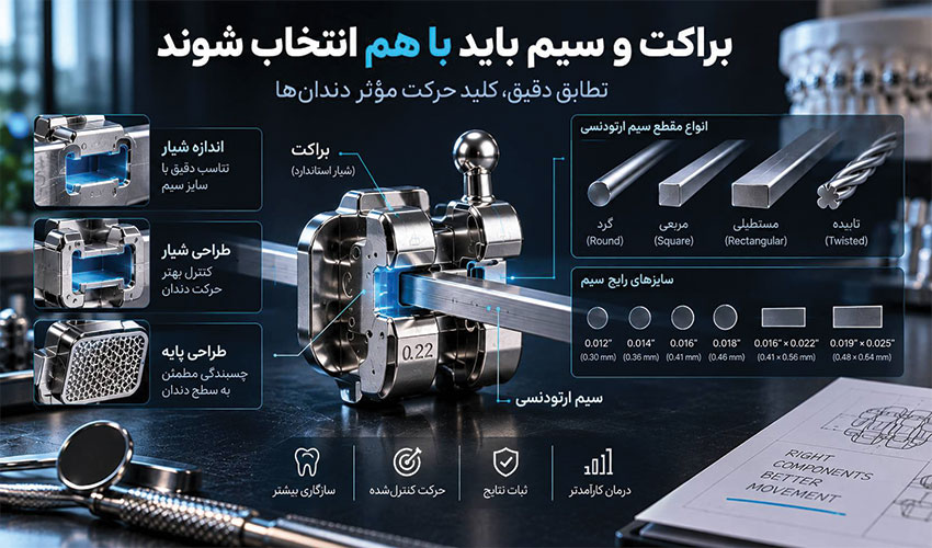 تطابق فنی براکت و سیم ارتودنسی