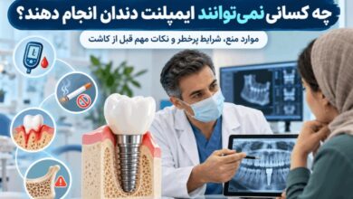 چه کسانی نمیتوانند ایمپلنت دندان انجام دهند و چه شرایطی پرخطر است