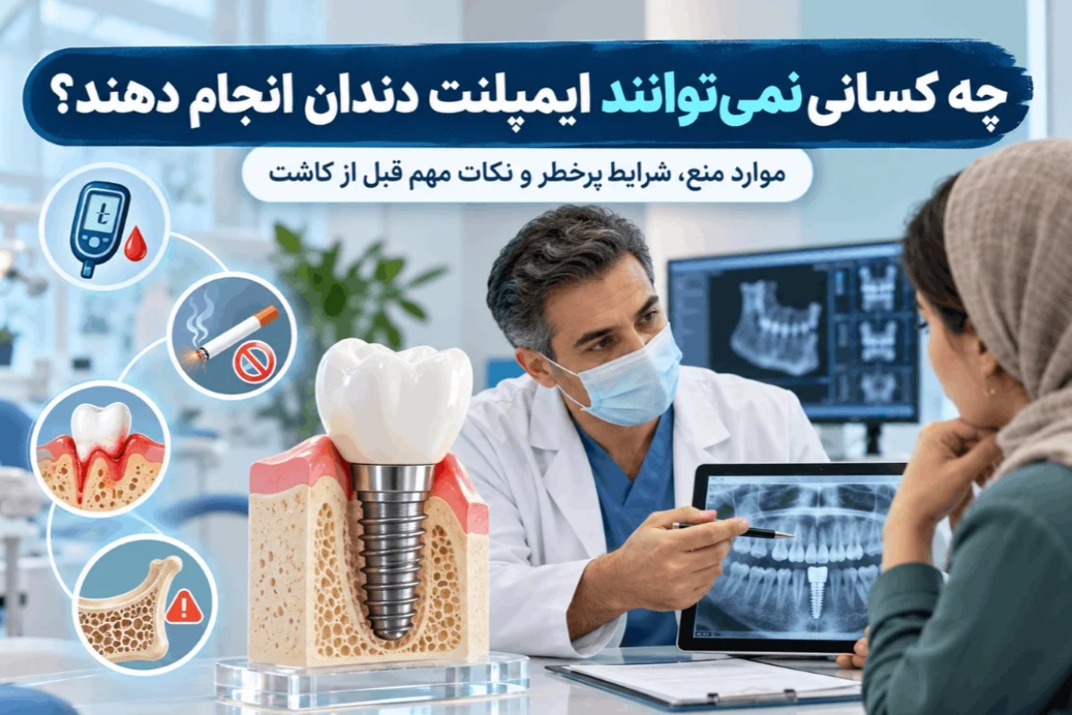 چه کسانی نمیتوانند ایمپلنت دندان انجام دهند و چه شرایطی پرخطر است